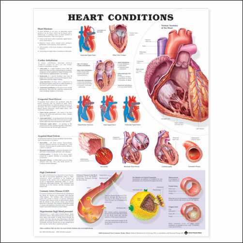 Heart Conditions Anatomical Chart