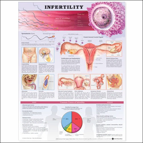 Infertility  2nd Edition Anatomical Chart