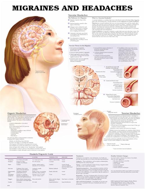 Migraines and Headaches Anatomical Chart