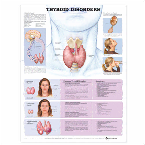 Thyroid Disorders Anatomical Chart