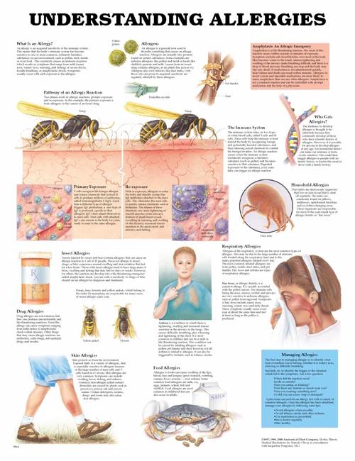 Understanding Allergies Anatomical Chart