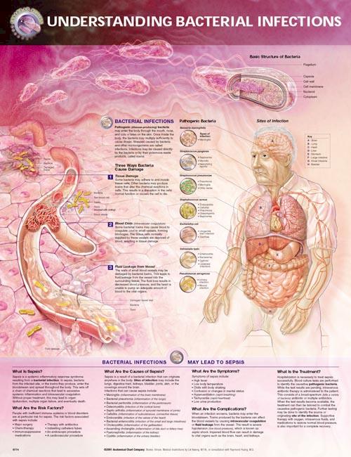 Understanding Bacterial Infections Anatomical Chart