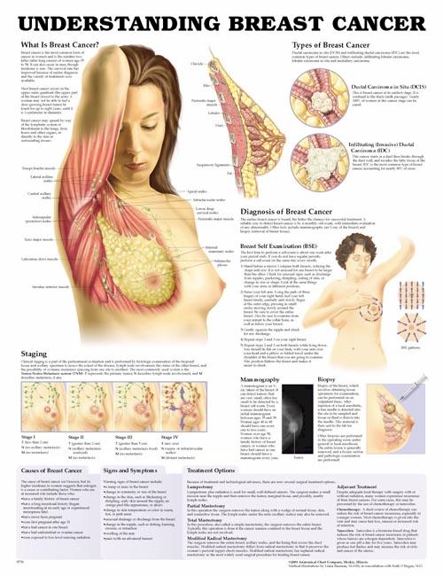 Understanding Breast Cancer Anatomical Chart