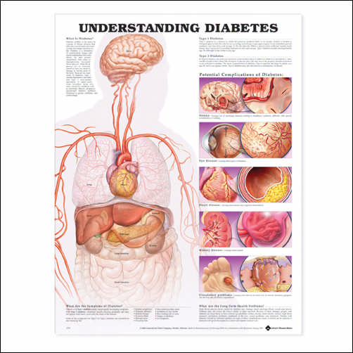 Understanding Diabetes Anatomical Chart