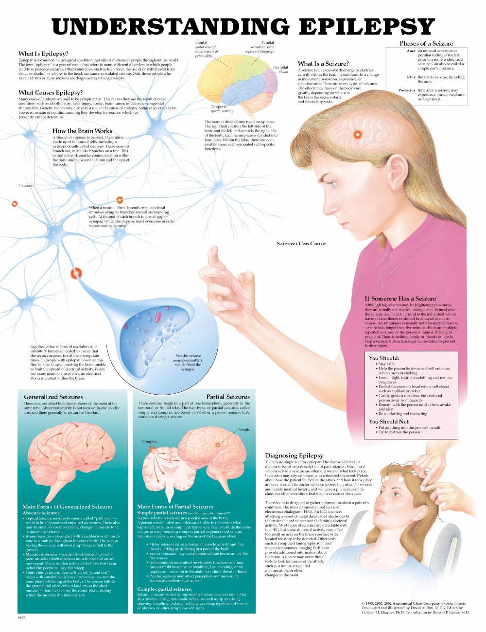 Understanding Epilepsy Anatomical Chart